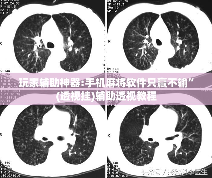 玩家辅助神器:手机麻将软件只赢不输”(透视挂)辅助透视教程