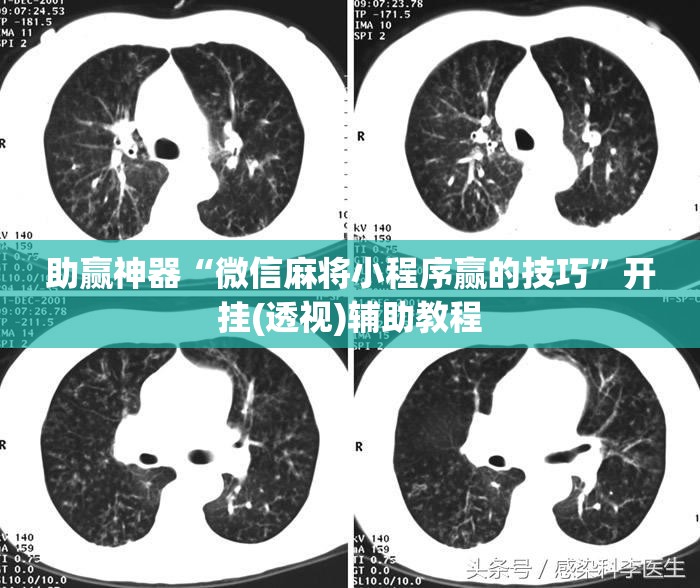 助赢神器“微信麻将小程序赢的技巧”开挂(透视)辅助教程