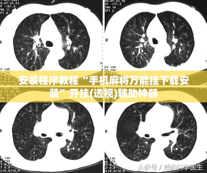 安装程序教程“手机麻将万能挂下载安装”开挂(透视)辅助神器