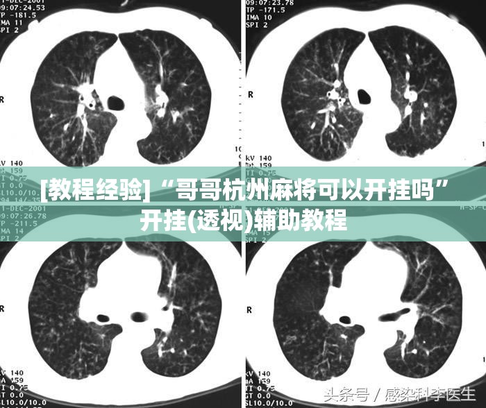 [教程经验]“哥哥杭州麻将可以开挂吗”开挂(透视)辅助教程