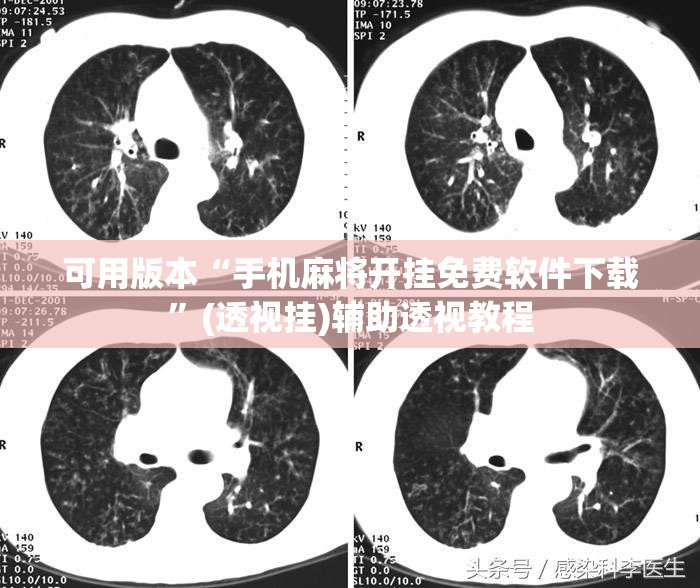 可用版本“手机麻将开挂免费软件下载	”(透视挂)辅助透视教程