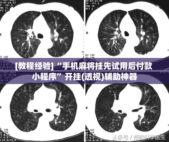 [教程经验]“手机麻将挂先试用后付款 小程序”开挂(透视)辅助神器