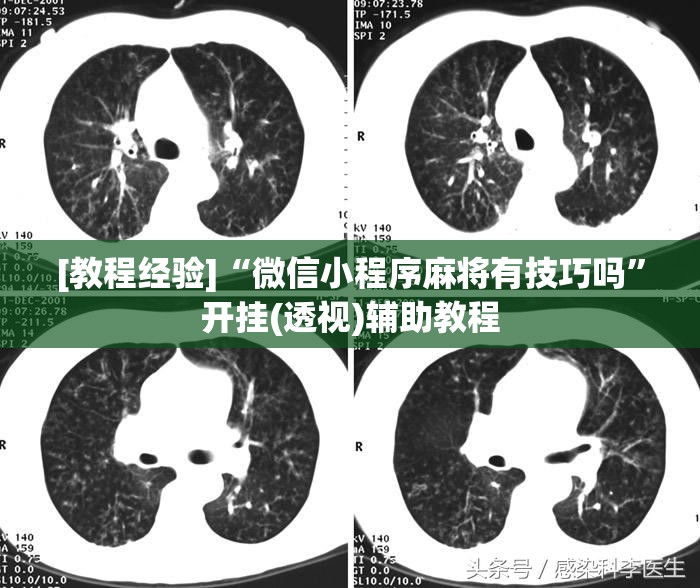 [教程经验]“微信小程序麻将有技巧吗”开挂(透视)辅助教程