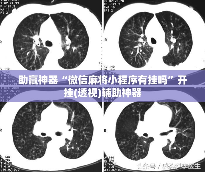 助赢神器“微信麻将小程序有挂吗”开挂(透视)辅助神器