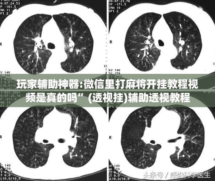 玩家辅助神器:微信里打麻将开挂教程视频是真的吗”(透视挂)辅助透视教程