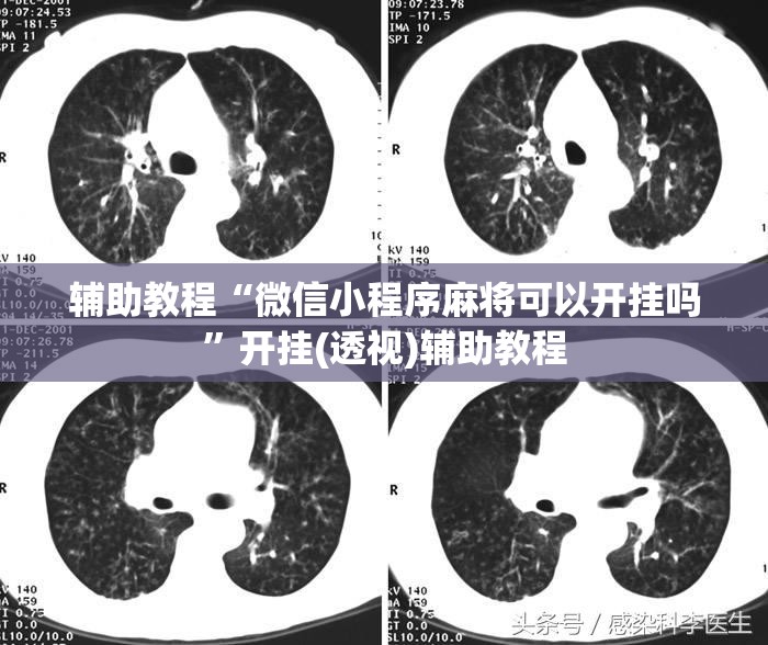 辅助教程“微信小程序麻将可以开挂吗”开挂(透视)辅助教程